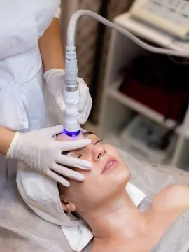 La Vie MD: Acne Laser Treatment